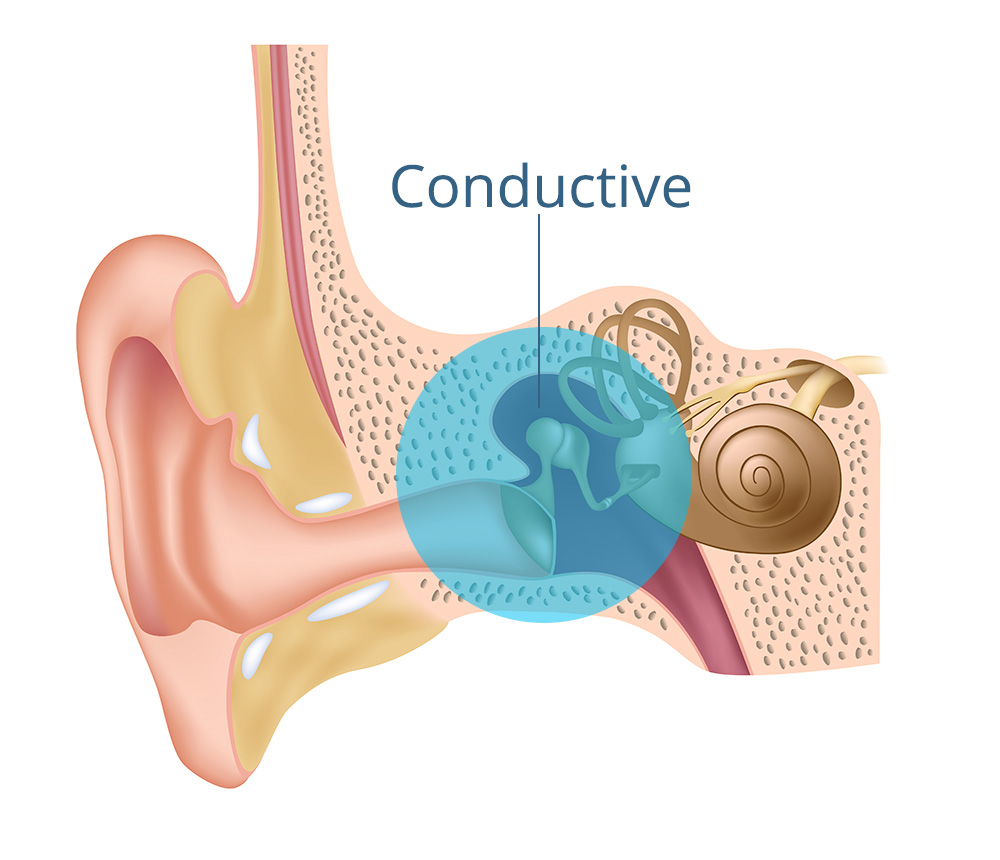 Hearing Health Facts And Information To Help With Your Hearing 